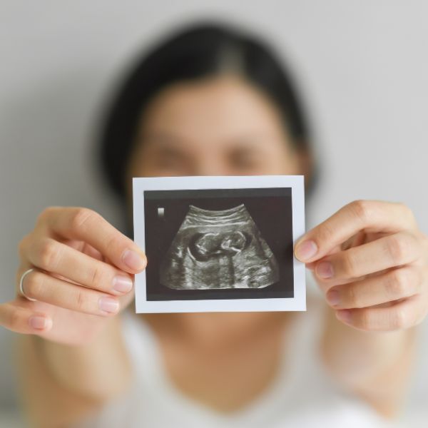 Eine Frau hält ein Ultraschallbild, das für die erfolgreiche natürliche Begleitung bei Kinderwunsch durch alternative Frauenheilkunde Hamburg steht.
